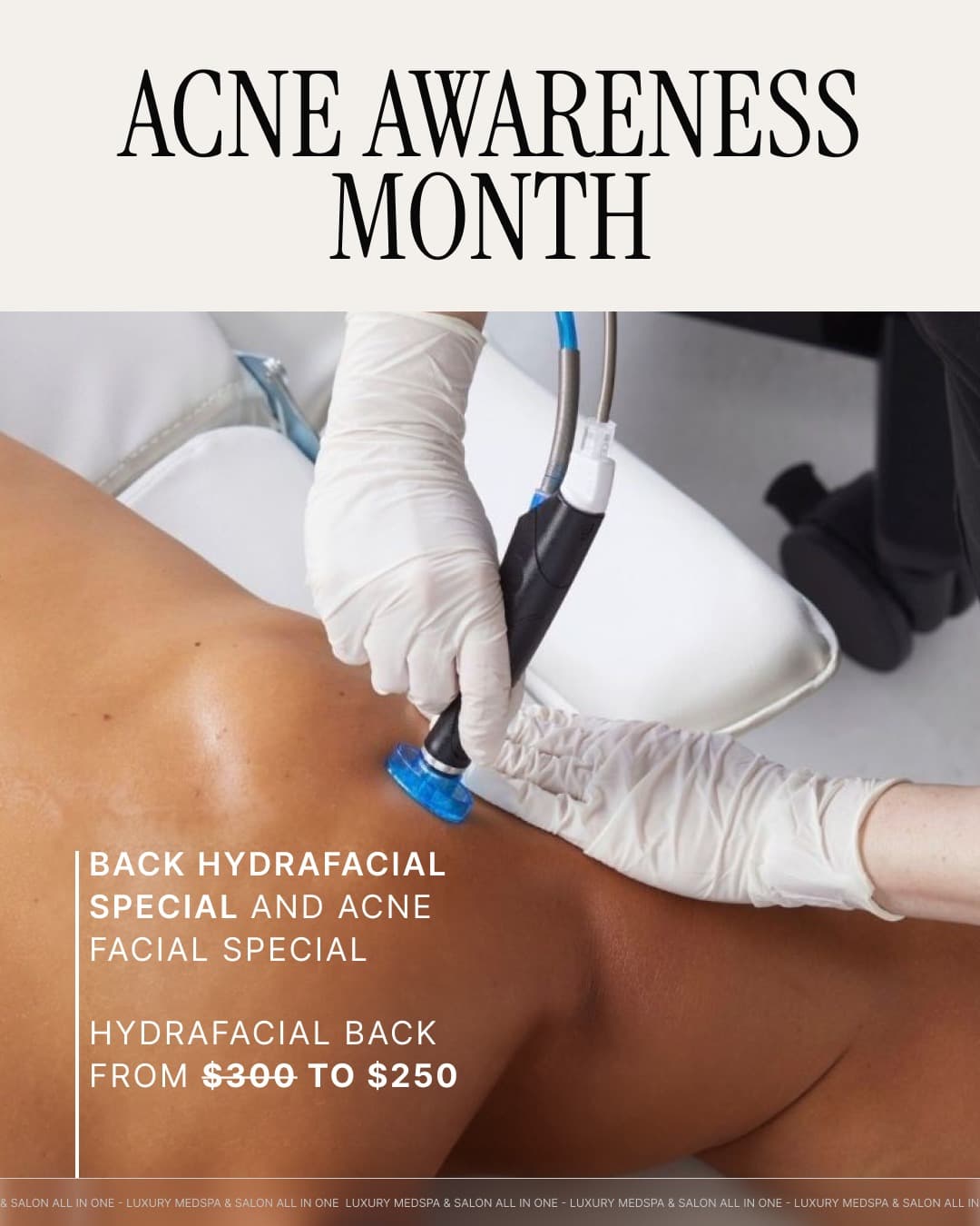 Acne Awareness - Back HydraFacial